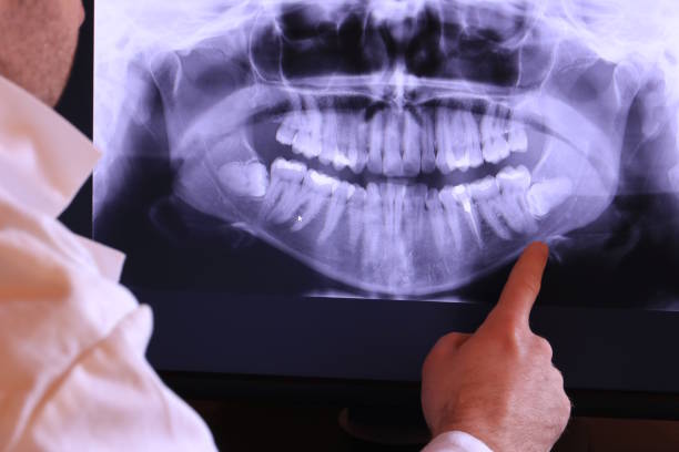 Best Mobile Emergency Dentist in West York, PA